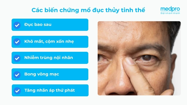 Biến chứng sau khi mổ đục thủy tinh thể