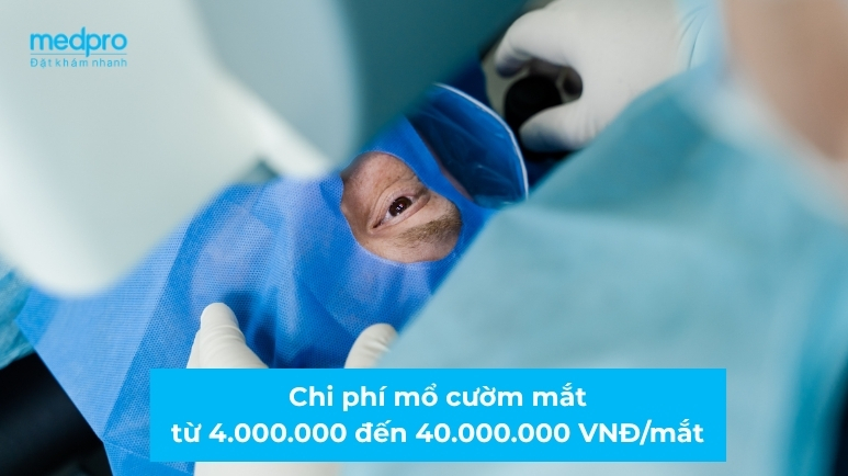 Mổ cườm mắt giá bao nhiêu tiền