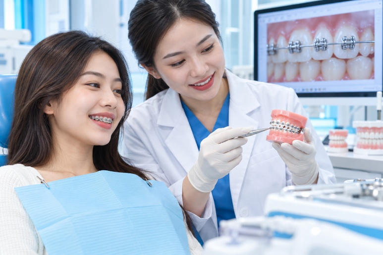 Niềng răng mắc cài kim loại thường