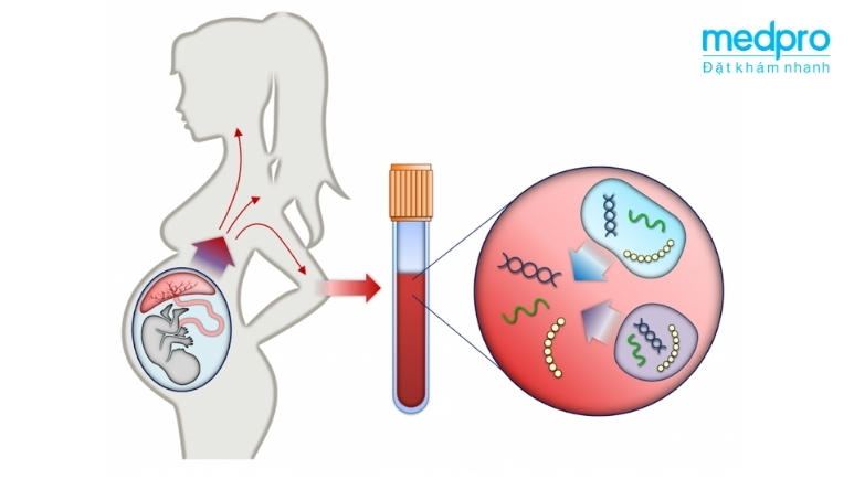 Xét nghiệm ADN thai nhi NIPT